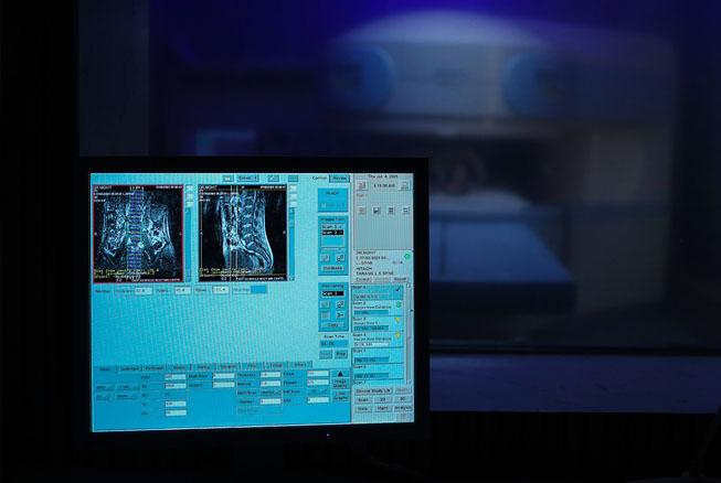Joint MRI