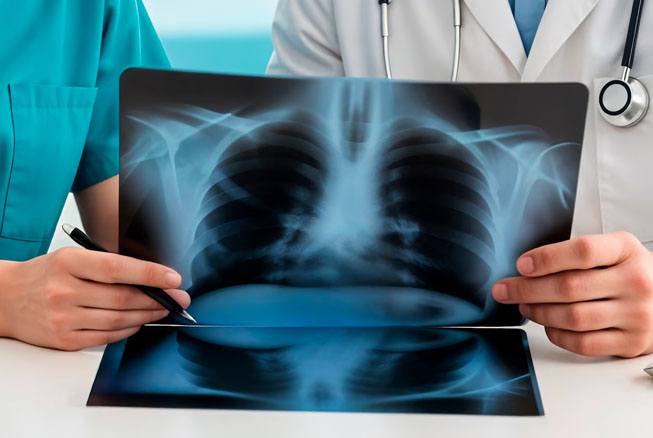 Chest X-Ray Bijnor